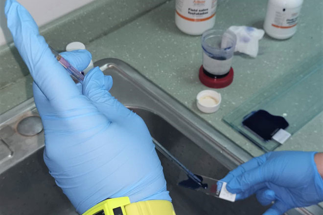 Panamá: culmina fase inicial de tratamiento vía «plasma convaleciente»