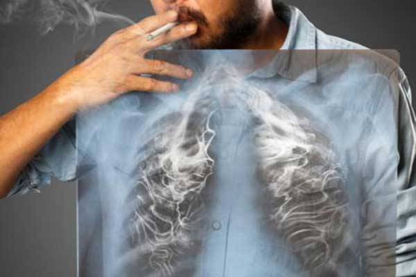 Fortalecerán en Panamá estrategias para disminuir muertes por tabaco en el mundo