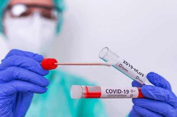 Advierten que Covid va en aumento, CSS reporta más de 50 casos
